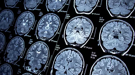 Celebrities are turning to MRI scans to help predict future illnesses. Should the rest of us?