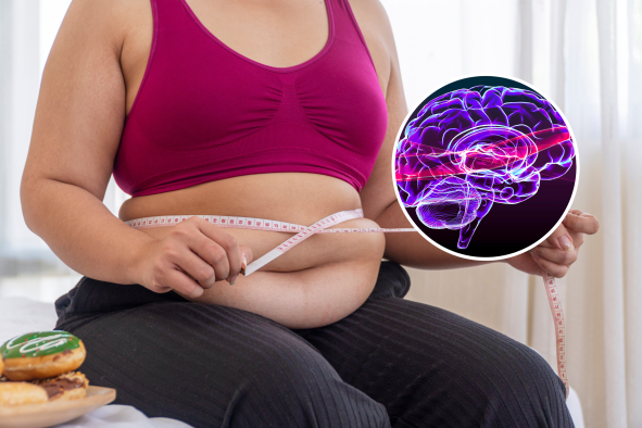 Belly Fat May Increase Alzheimer's Risk, Neuroscientists Warn