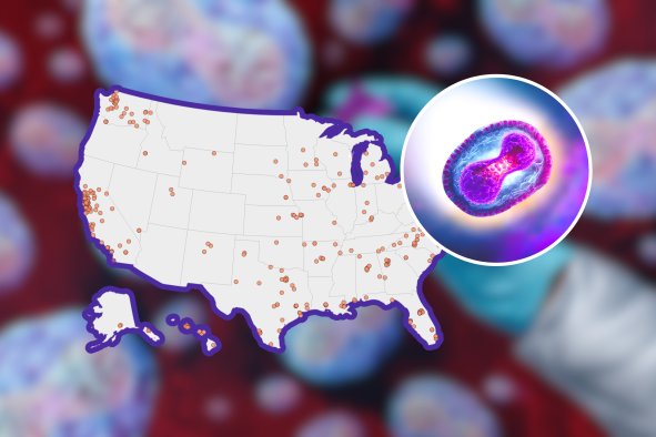 CDC Updates Mpox Map, Advises Best Vaccination, Other Protections