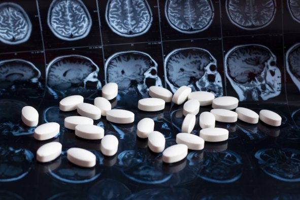 Cancer Drug May Reverse Alzheimer's Disease